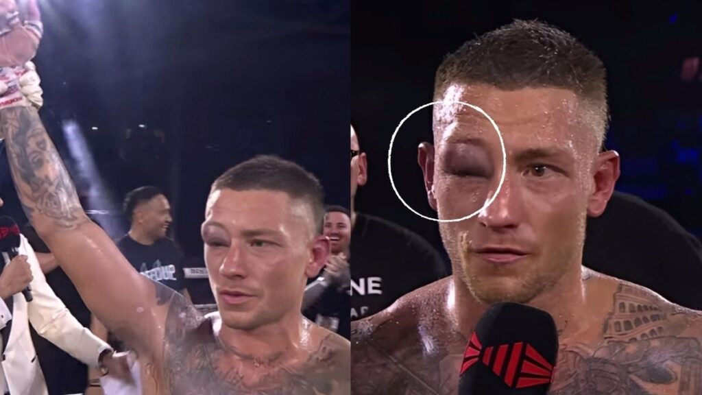 Liam Paro babak belur tapi menang melawan Papot