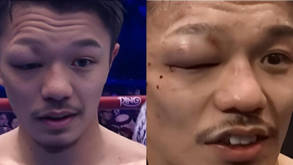 junto nakatani babak belur tapi menang