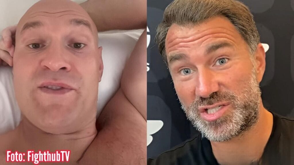 Tyson Fury marah pada kubu Joshua