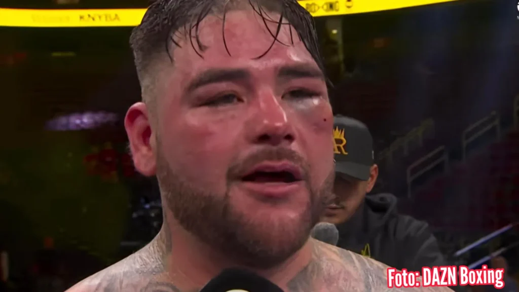 Andy Ruiz kalah mutlak atas Damian Knyba